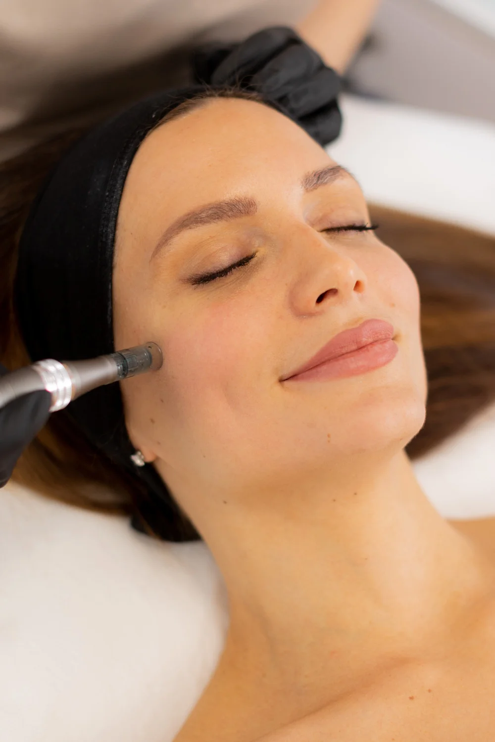 Microneedling Behandlung bei Maru Kosmetik